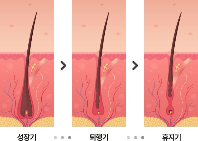 Hair Cycle