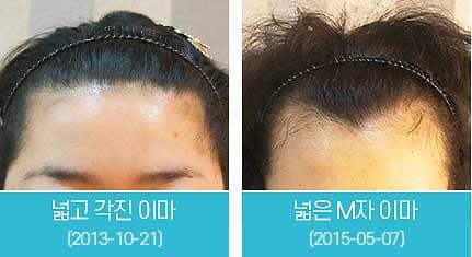 다양한 여성헤어라인1