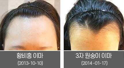 다양한 여성헤어라인2